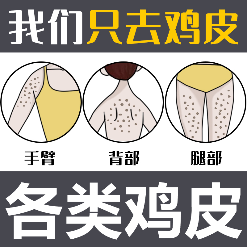 色素型鸡皮肤改善(鸡皮肤色素怎么消除)