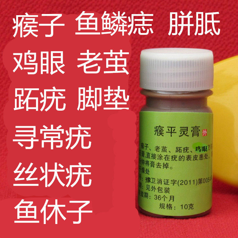 去除瘊子鸡眼膏贴跖疣寻常疣丝状疣鱼休子鱼鳞痣刺猴拓尤老茧脚垫