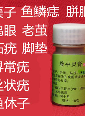 去除瘊子鸡眼膏老茧脚垫跖疣