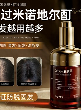 防脱密发液头皮发际线侧柏叶生姜精华营养剂快速增育固发长男女生