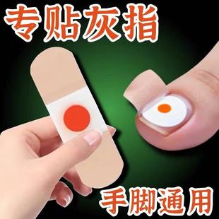 专用贴植物萃取脚趾手指甲专用 指甲贴正品 香港大药坊
