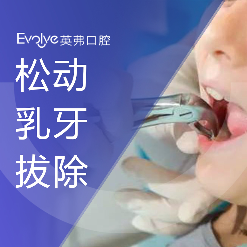 杭州英弗口腔儿童松动乳牙拔除