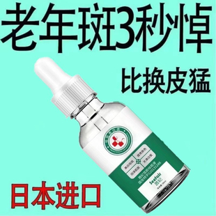 【消斑】除斑液祛斑点黑色素色斑老年斑晒斑雀斑美白精华液