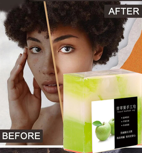 apple handmade sopa african black skin spot acne remove香皂