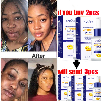 VitaminEFacialserumLifting