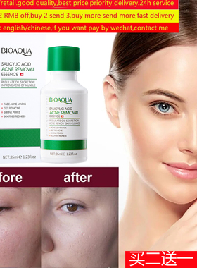 Shrink Pores Face Serum Salicylic Acid Remove Acne水杨酸祛痘