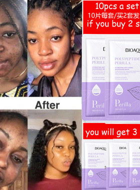 Polypeptide Perilla Facial Masks Moisturizing Anti-aging面膜