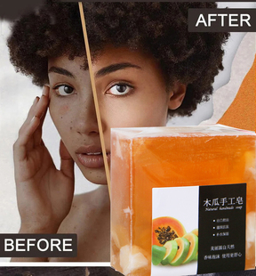 Spot Remove bath Soap clean木瓜皂 Tone Dark Skin Papaya Even