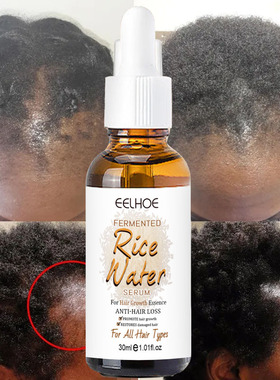 Plant Rice Water Hair Growth Serum Baldness Prevent loss精油