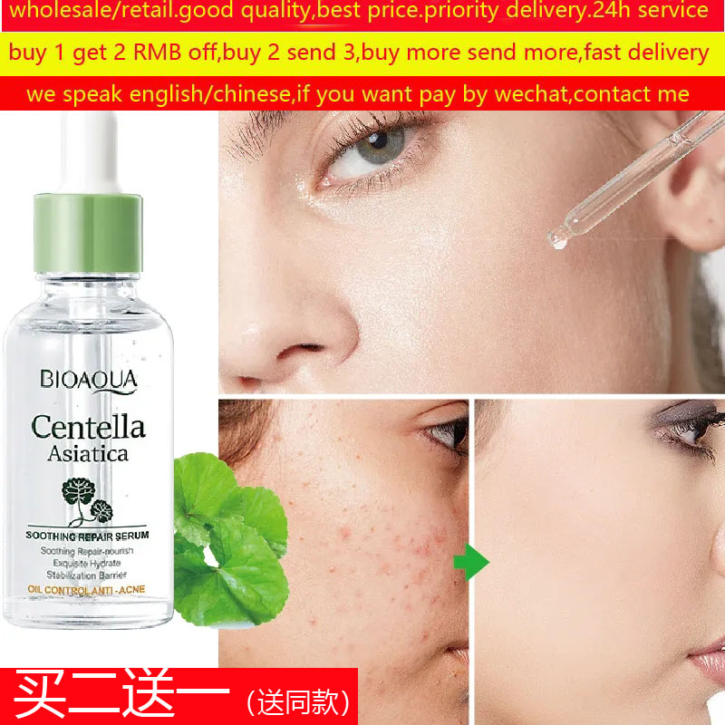 Centella Asiatica Acne Removing Essence Face Serum精华液痘痘 美容护肤/美体/精油 液态精华 原图主图