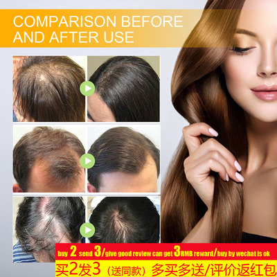 BiotinHairGrowthSpray