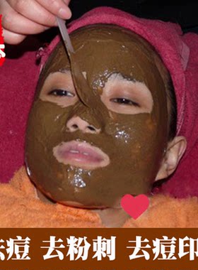 纯中药祛痘面膜粉非软膜粉中药面膜祛痘淡化痘印控油去闭口粉刺
