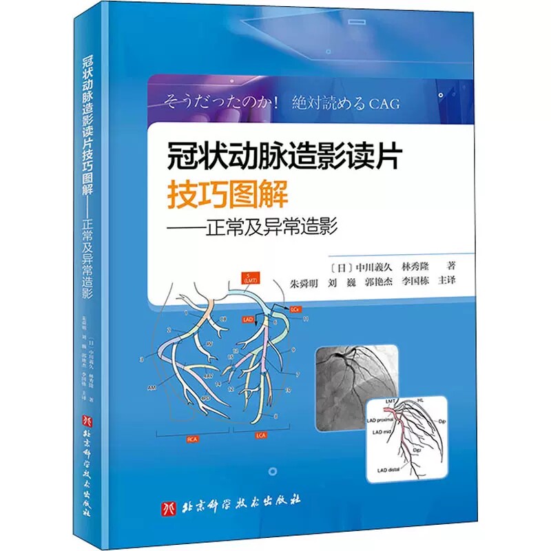 冠状动脉造影读片技巧图解 正常及异常造影 9787571419929 正确解读冠状动脉造影片中正常冠状动脉和异常影像 北京科学技术书籍