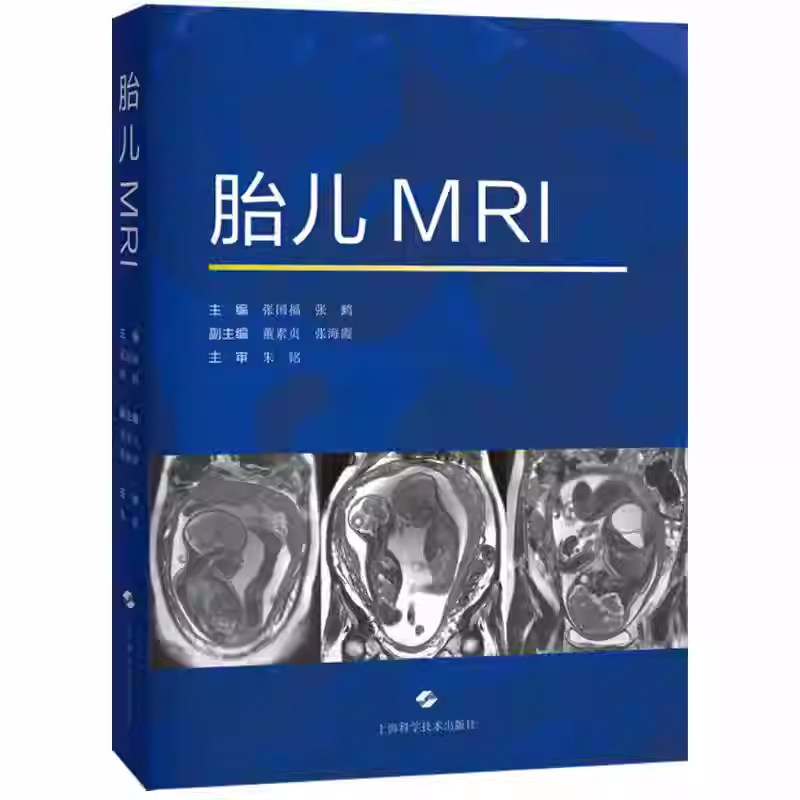 胎儿MRI 张国福 张鹤 主编 本书对从事胎儿磁共振的影像科医师和新生儿医师、产科医师都有帮助 9787547873083 上海科学技术出版社