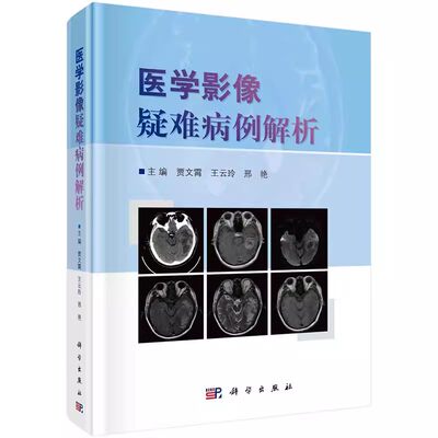 医学影像疑难病例解析 贾文霄等编颅脑头颈五官脊柱脊髓心胸乳腺腹腔与腹膜后消化系统泌尿生殖系统骨肌系统疑难病例解析及讨论