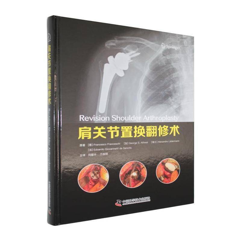肩关节置换翻修术 原   医药卫生书籍中国科学技术出版社
