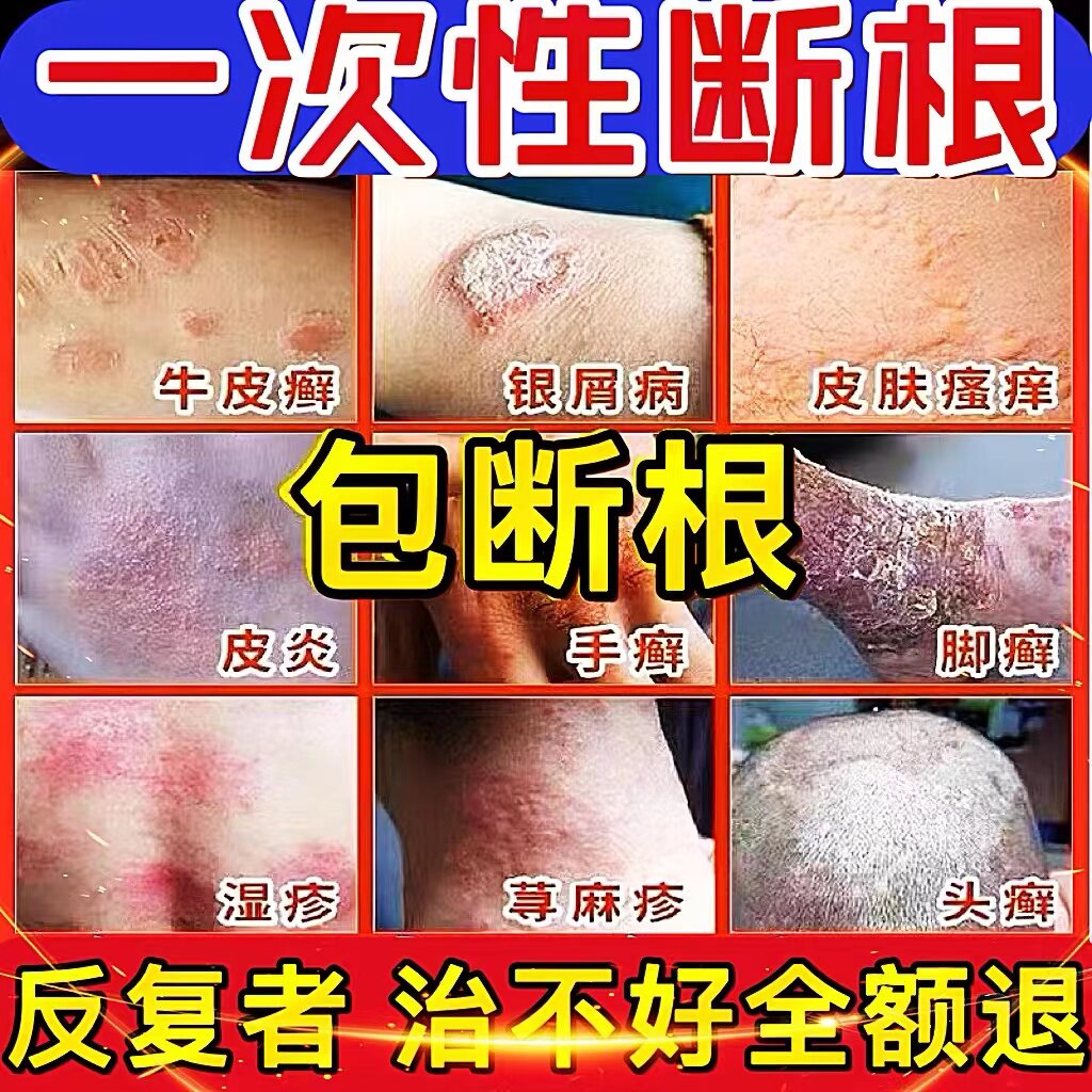 10w 用后都说好{不满意就退}已治愈5842541人活动限时活动中2送1