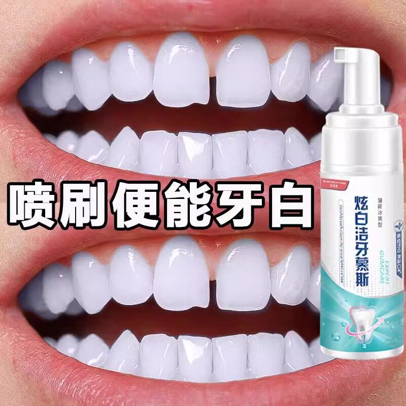 牙渍一擦即除~黑色烟渍~茶渍~去牙菌斑咖啡渍牙齿变白