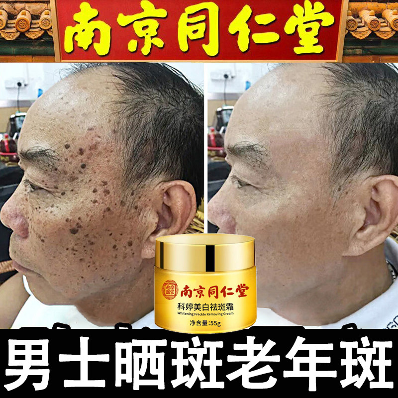 【男士专用】南京同仁堂祛斑霜