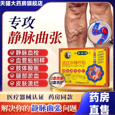 静脉曲张贴腿部青筋凸起