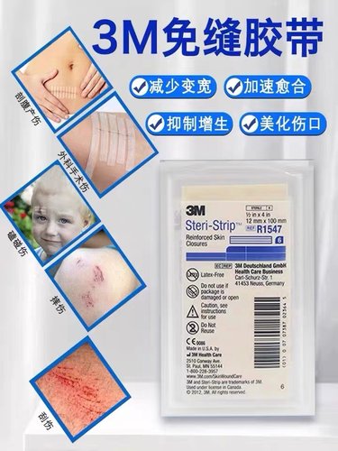 3M皮肤伤口免缝胶带R1547