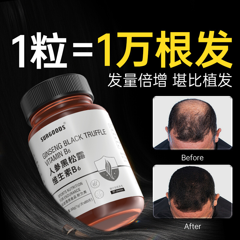 【1粒=1万根头发】生物素生发b6