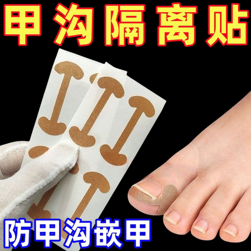 指甲矫正器嵌甲隔离脚趾甲长肉