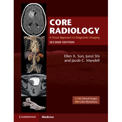 Core Radiology A Visual Approach to Diagnostic Imaging 核心放射学:诊断成像的视觉方法 9781108965910