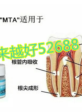 牙科 武汉观雅 MTA 陶瓷根管水泥 侧穿 底穿修补 倒充填 盖髓正品