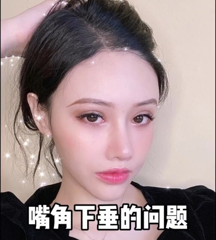 草本嘴角上扬精华 改善下垂提升嘴角精油