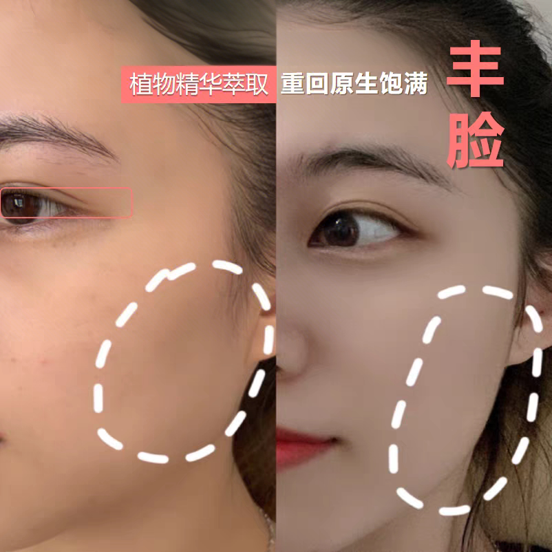 丰脸圆润精华液紧致修复面部脸颊太阳穴额头扁平内陷饱满去法令纹