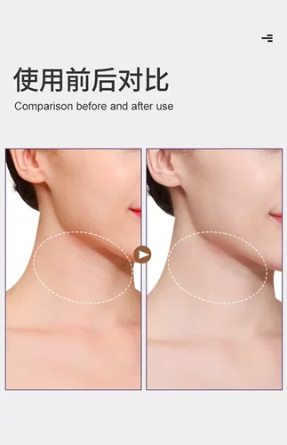 草本颈阔肌收紧精华 提拉紧致改善松驰去颈纹嫩白光滑天然免洗