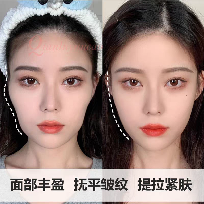 丰脸圆润精华液紧致饱满修复面部脸颊太阳穴额头内陷去法令纹抗皱