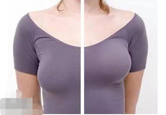 乳房上提精华 提升坚挺改善胸部下垂精油 新客限拍一瓶拍多不发货