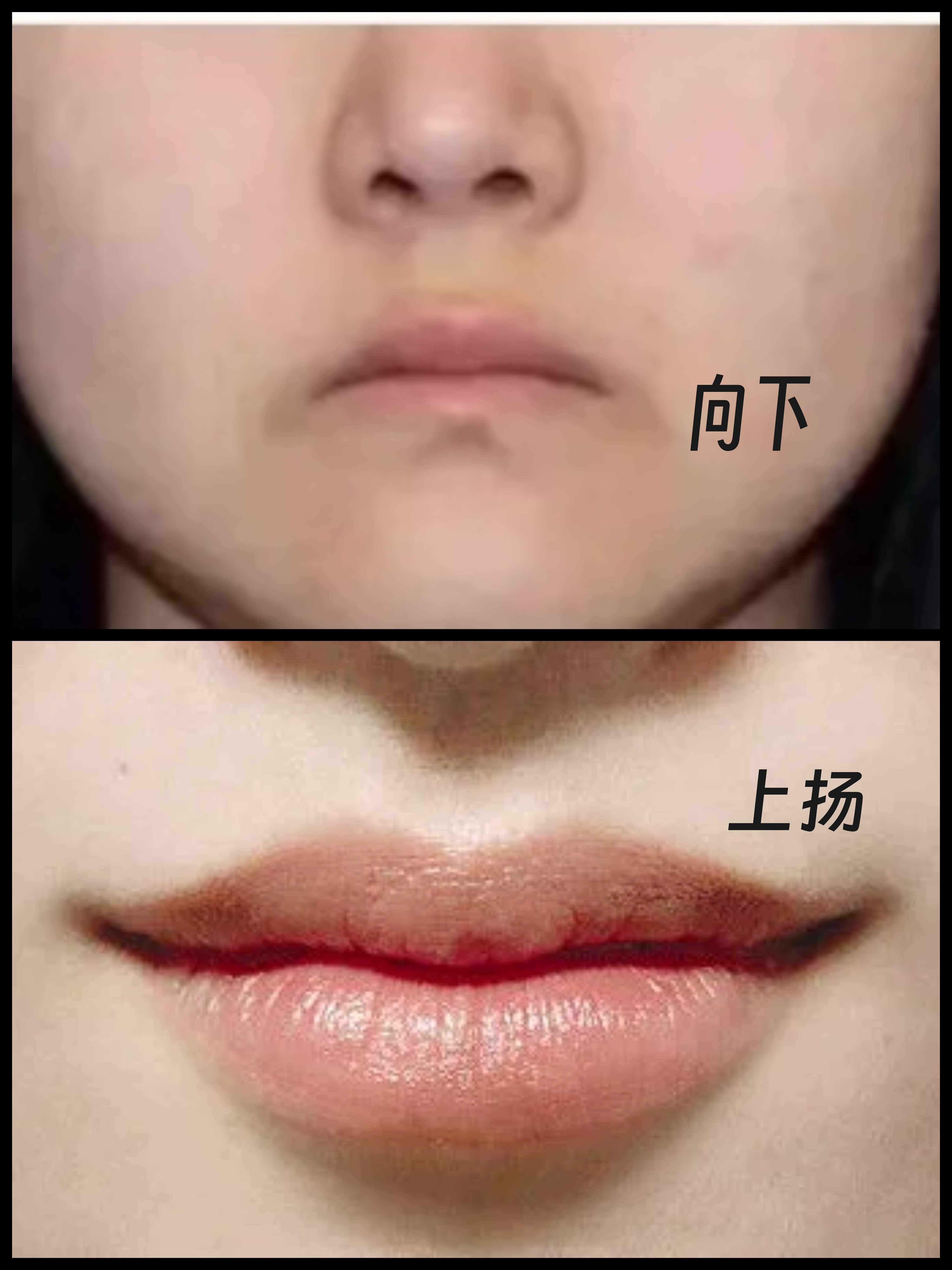草本嘴角向下修复精华 改善下垂嘴角上扬精油天然免洗