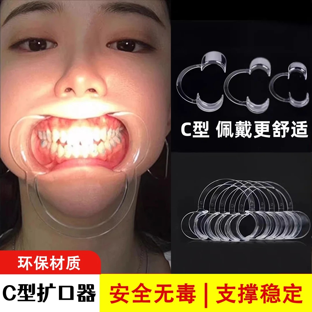 开口器牙科看牙洗牙扩嘴张口器牙齿美白牙结石撑嘴工具神器高温