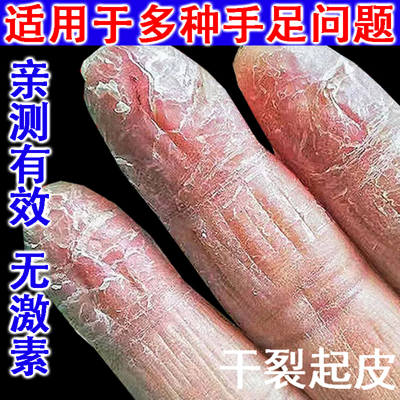 手指头干裂脚后跟皲裂滋润保湿修脚膜足补水复秋冬棒膏正品护手霜,洗护清洁剂/卫生巾/纸/香薰,身体乳液,淘宝优惠券,粉丝福利购,淘宝优惠卷