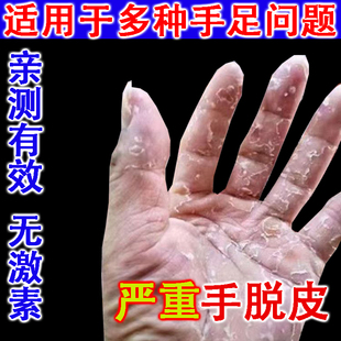手指头干裂脚后跟皲裂滋润保湿修脚膜足补水复秋冬棒膏正品护手霜
