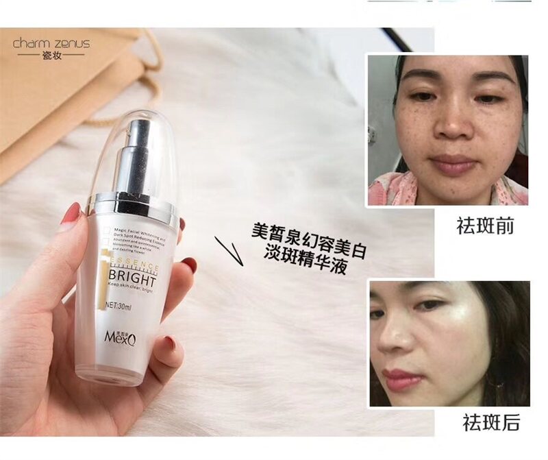 美皙泉幻容美白淡斑精华液30g 深滋润祛斑补水男女士护肤官网正品