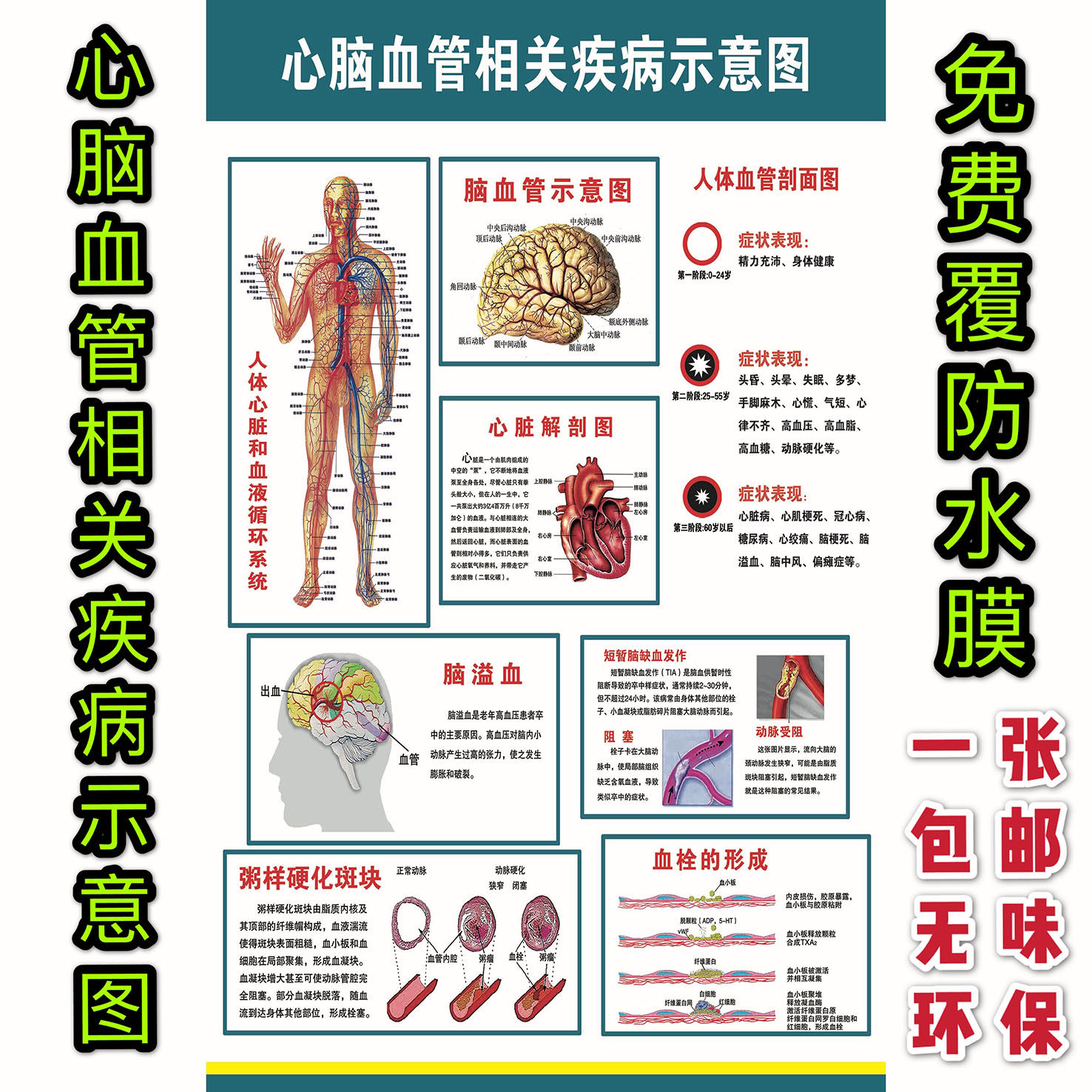 心脑血管相关疾病血栓脑溢血粥样硬化斑块示意图海报医院科室挂图
