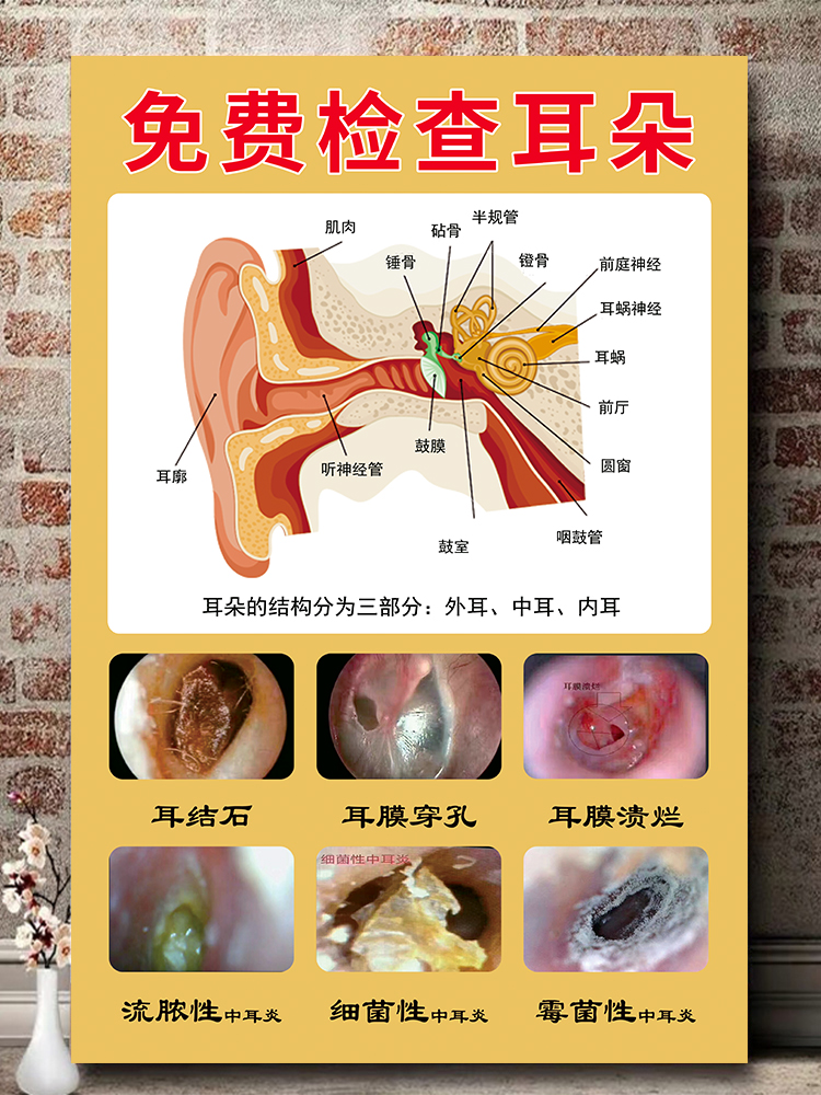 采耳图片中耳炎海报免费检查耳朵常见耳病症状挂图采耳店装饰挂画