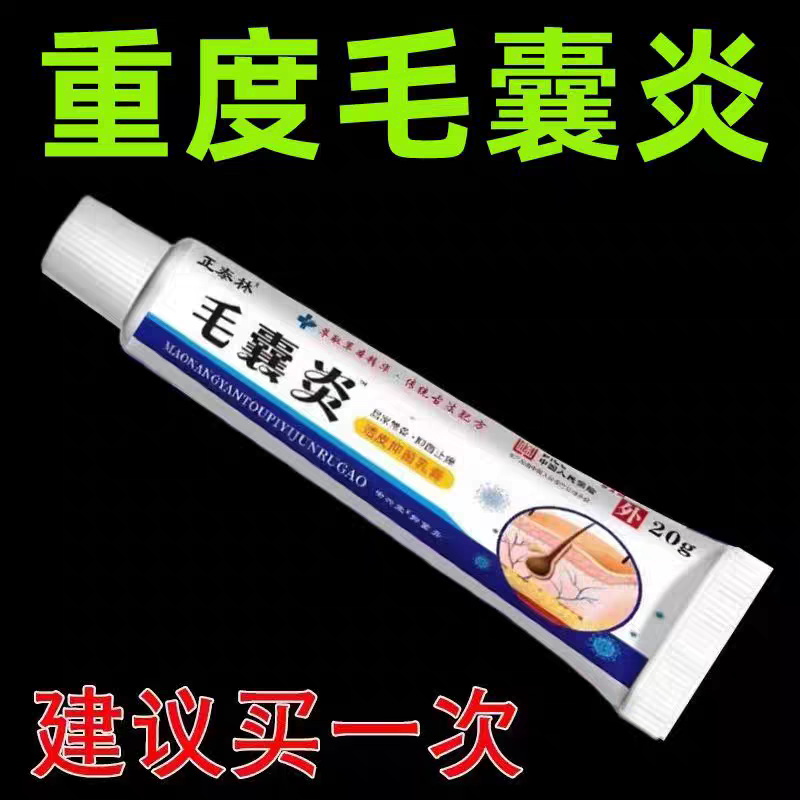 头上长痘痘脓包疙瘩头毛囊炎脓疮毛囊发炎堵塞抑菌止痒乳膏