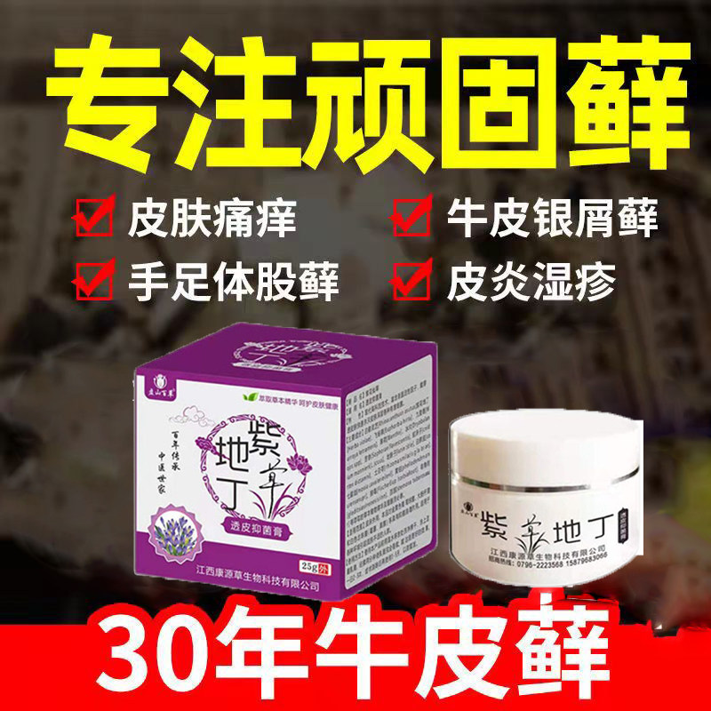 紫草地丁治头皮屑藓皮炎牛皮银屑头部痒毛囊炎膏病真菌感染专用屑