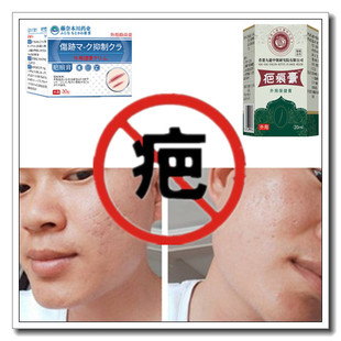 修复祛凸疤开伤疤痕印灵消除去增生性冻疮疙瘩手术产后色素药乳液