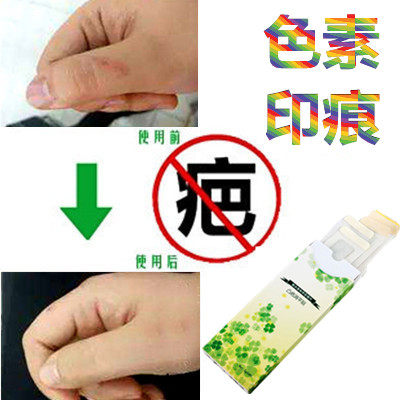 草本祛红印去除色素沉淀回流增生疤痕贴凸疤疙瘩淡化黑色素印产品,美容护肤/美体/精油,复方精油,淘宝优惠券,粉丝福利购,淘宝优惠卷