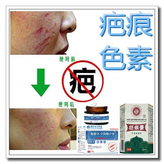 正品去除手术烟烫疤痕印消祛儿童增生性突疤疙瘩软化烧伤药膏产品,洗护清洁剂/卫生巾/纸/香薰,身体乳液,淘宝优惠券,粉丝福利购,淘宝优惠卷