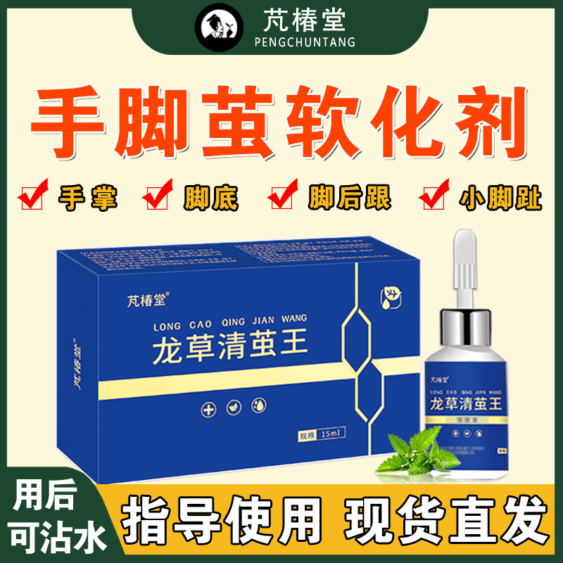 芃椿堂正品去小脚趾鸡茧脚底老茧神器手掌厚茧脚垫硬皮去除软化剂