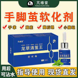 芃椿堂正品去小脚趾鸡茧脚底老茧神器手掌厚茧脚垫硬皮去除软化剂