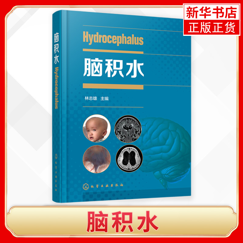 脑积水临床医学脑手术周良辅赵继宗王忠诚神经外科颅底手术显微外科神经内镜神经外科学书籍脑血管脑外科颅脑损伤新华正版