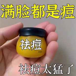 苦参去痘膏保湿 舒缓淡化青春痘祛痘印男生女闭口粉刺克星面霜国货